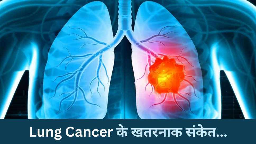 cancer ,lung ,lung cancer ,treatment ,symptoms ,Health,  persistent chest burning, lung cancer signs, chest discomfort, lung cancer symptoms, health warning, lung health tuberculosis,smoking,lung cancer symptoms,air pollution,फेफड़ों का कैंसर, फेफड़ों का कैंसर कैसे होता है ,फेफड़ों के कैंसर के लक्षण,